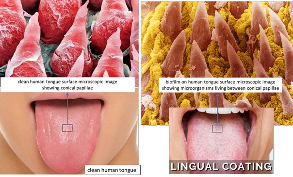 Human tongue comparison 2.jpg